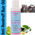 Vigini Natural Anti-Dandruff Hair Care Oil (100ml)